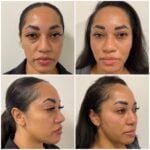Eternia Medspa's Signature Treatments for Younger, Healthier Skin