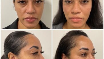 Eternia Medspa's Signature Treatments for Younger, Healthier Skin